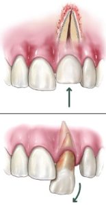 dental trauma dental trauma